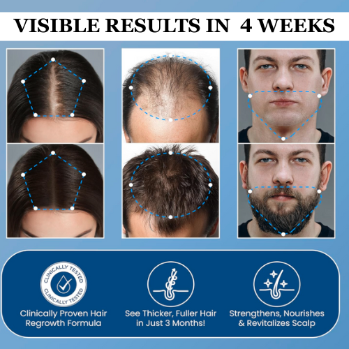 Aparthy Hair Growth Roll on Serum